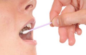 Il test genetico non invasivo